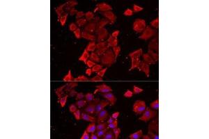 Immunofluorescence analysis of MCF7 cells using TIMM17A Polyclonal Antibody (TIMM17A antibody)