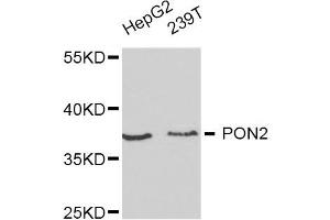 Western blot analysis of extracts of HepG2 and 293T cell lines, using PON2 antibody. (PON2 antibody)