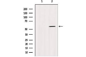 Western blot analysis of extracts from Myeloma cells, using Cytochrome P450 1A2 Antibody.