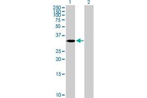 Western Blot analysis of ASB4 expression in transfected 293T cell line by ASB4 MaxPab polyclonal antibody. (ASB4 antibody  (AA 1-349))
