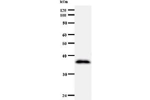 Western Blotting (WB) image for anti-Cyclin F (CCNF) antibody (ABIN931023) (Cyclin F antibody)