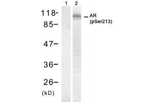 Western blot analysis of extract from DU145 cell, using Androgen Receptor (phospho-Ser213) antibody (E011119). (Androgen Receptor antibody  (pSer213))