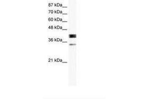 Image no. 1 for anti-Nuclear Receptor Subfamily 5, Group A, Member 1 (NR5A1) (AA 174-223) antibody (ABIN202573) (NR5A1 antibody  (AA 174-223))