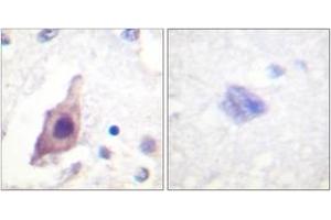 Immunohistochemistry analysis of paraffin-embedded human brain tissue, using CDC25B (Ab-353) Antibody. (CDC25B antibody  (AA 319-368))