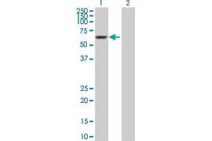Western Blot analysis of MTF2 expression in transfected 293T cell line by MTF2 MaxPab polyclonal antibody. (MTF2 antibody  (AA 1-536))