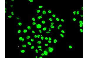 Immunofluorescence analysis of U2OS cells using EFTUD2 antibody (ABIN5974236). (EFTUD2 antibody)