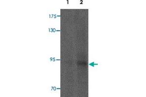 Western blot analysis of SYTL5 in HeLa cell lysate with SYTL5 polyclonal antibody  at 1 ug/mL (lane 1) and 2 ug/mL (lane 2). (SYTL5 antibody  (N-Term))