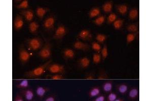 Immunofluorescence analysis of HeLa cells using CDK11B Polyclonal Antibody at dilution of 1:100. (CDK11 antibody)