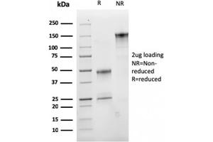 SDS-PAGE Analysis Purified CD47 Mouse Monoclonal Antibody (IAP/2937). (CD47 antibody  (AA 18-135))