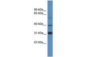 Image no. 1 for anti-SRY (Sex Determining Region Y)-Box 1 (SOX1) (AA 313-362) antibody (ABIN6746081) (SOX1 antibody  (AA 313-362))