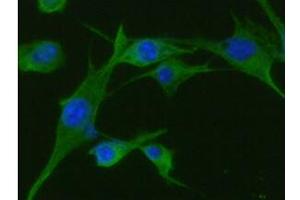 ICC/IF analysis of TPMT in U87MG cells line, stained with DAPI (Blue) for nucleus staining and monoclonal anti-human TPMT antibody (1:100) with goat anti-mouse IgG-Alexa fluor 488 conjugate (Green). (TPMT antibody  (AA 1-245))