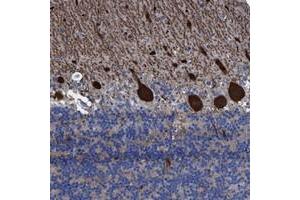 Immunohistochemical staining of human cerebellum with TXNDC17 polyclonal antibody  shows strong cytoplasmic positivity in Purkinje cells. (TXNDC17 antibody)