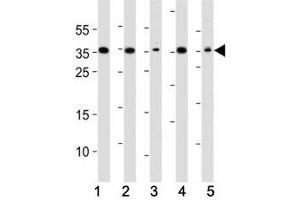 Western blot analysis of lysate from (1) A549, (2) HeLa, (3) HepG2, (4) Jurkat, (5) mouse NIH3T3 cell line using DKK1 antibody. (DKK1 antibody)
