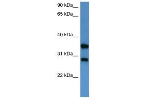 Western Blot showing STYXL1 antibody used at a concentration of 1-2 ug/ml to detect its target protein. (STYXL1 antibody  (Middle Region))