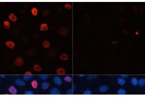 Immunofluorescence analysis of HeLa cells using Phospho-γH2A. (gamma H2AX antibody  (pSer139))