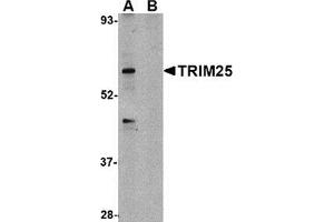 Western blot analysis of TRIM25 in HeLa cell lysate in (A) the absence and (B) presence of blocking peptide with this product at 1 μg/ml. (TRIM25 antibody  (C-Term))