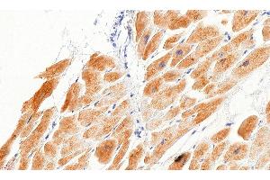 Immunohistochemistry (IHC) image for anti-Desmin (DES) (C-Term) antibody (ABIN334386)