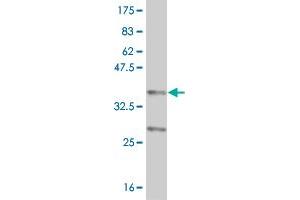 Western Blot detection against Immunogen (37. (NR4A2 antibody  (AA 147-250))