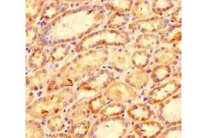 Immunohistochemistry of paraffin-embedded human kidney tissue using ABIN7177041 at dilution of 1:100 (CXCL11 antibody  (AA 22-98))