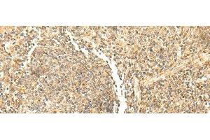 Immunohistochemistry of paraffin-embedded Human tonsil tissue using DHFR Polyclonal Antibody at dilution of 1:50(x200) (Dihydrofolate Reductase antibody)