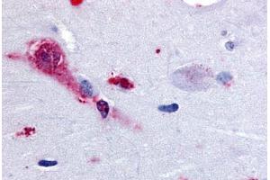 Human Brain, Amygdala (formalin-fixed, paraffin-embedded) stained with TAAR1 antibody ABIN213367 at 28 ug/ml followed by biotinylated goat anti-rabbit IgG secondary antibody ABIN481713, alkaline phosphatase-streptavidin and chromogen. (TAAR1 antibody  (Cytoplasmic Domain))