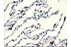 Immunohistochemical staining of paraffin-embedded Human lung tissue using anti-CENPH mouse monoclonal antibody.