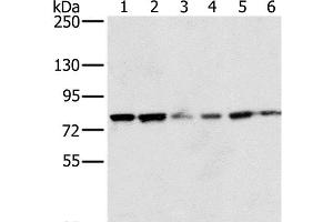 Western Blot analysis of 293T and hela cell, Human testis tissue, skov3, Raji and Jurkat cell using NOX5 Polyclonal Antibody at dilution of 1:200 (NOX5 antibody)