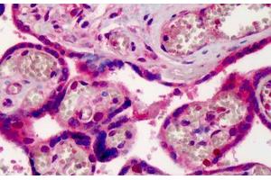 Human Placenta: Formalin-Fixed, Paraffin-Embedded (FFPE) (XPO1 antibody  (AA 390-408))