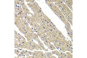 Immunohistochemistry of paraffin-embedded rat heart using SGCD antibody. (SGCD antibody  (AA 61-290))