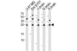 STMN2 antibody  (N-Term)