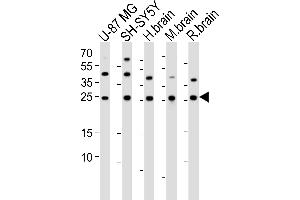 Western blot analysis of lysates from U-87 MG, SH-SY5Y cell line, human brain, mouse brain, rat brain tissue lysate (from left to right), using STMN2 Antibody (N-term) (ABIN6243305 and ABIN6577588). (STMN2 antibody  (N-Term))