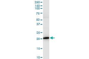 Immunoprecipitation of IL17C transfected lysate using anti-IL17C MaxPab rabbit polyclonal antibody and Protein A Magnetic Bead , and immunoblotted with IL17C MaxPab mouse polyclonal antibody (B01) . (IL17C antibody  (AA 1-197))