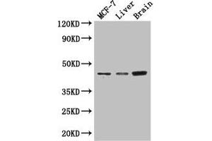 Western Blot Positive WB detected in: MCF-7 whole cell lysate, Mouse liver tissue, Mouse brain tissue All lanes: KCNJ11 antibody at 3 μg/mL Secondary Goat polyclonal to rabbit IgG at 1/50000 dilution Predicted band size: 44, 34 kDa Observed band size: 44 kDa (KCNJ11 antibody  (AA 172-390))