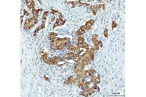 IHC analysis of XTP3TPA/DCTPP1 using anti-XTP3TPA/DCTPP1 antibody (ABIN7600677). (DCTPP1 antibody  (AA 22-170))