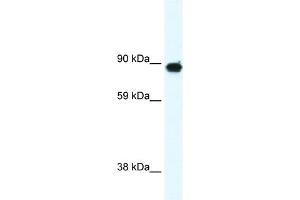 WB Suggested Anti-GRM6 Antibody Titration:  0.