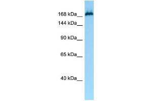 WB Suggested Anti-MAST1 Antibody Titration: 1. (MAST1 antibody  (N-Term))