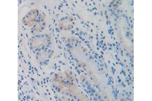 IHC-P analysis of Human Tissue, with DAB staining. (CKB antibody  (AA 11-367))