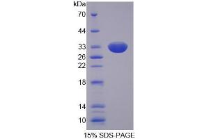 SDS-PAGE analysis of Human SLC22A11 Protein.