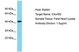 Image no. 1 for anti-Chromosome 4 Open Reading Frame 29 (C4ORF29) (AA 122-171) antibody (ABIN6750689) (C4ORF29 antibody  (AA 122-171))