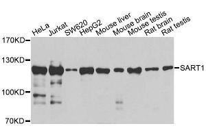 Western blot analysis of extracts of various cell lines, using SART1 antibody (ABIN5996293) at 1/1000 dilution.