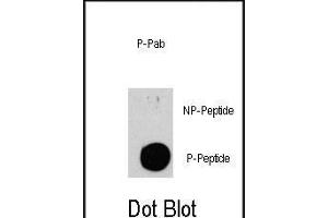 Dot blot analysis of anti-TSC2-p Phospho-specific Pab (Cat. (Tuberin antibody  (pSer939))
