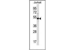Western blot analysis of FA8A1 Antibody (N-term) in Jurkat cell line lysates (35ug/lane). (FAM8A1 antibody  (N-Term))