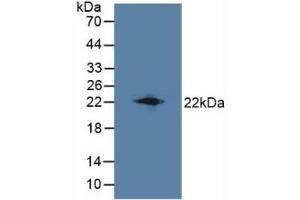 Detection of LCN8 in Mouse Testis Tissue using Polyclonal Antibody to Lipocalin 8 (LCN8)