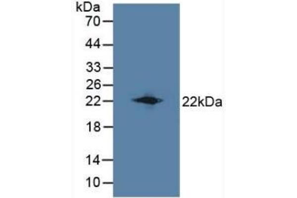 LCN8 抗体  (AA 27-176)