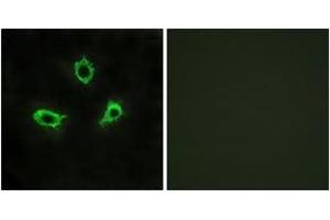 Immunofluorescence analysis of LOVO cells, using GPR115 Antibody. (G Protein-Coupled Receptor 115 antibody  (AA 641-690))