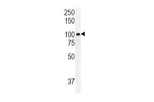 RASGRP1 Antibody (Center) (ABIN652037 and ABIN2840511) western blot analysis in HepG2 cell line lysates (35 μg/lane). (RASGRP1 antibody  (AA 495-521))