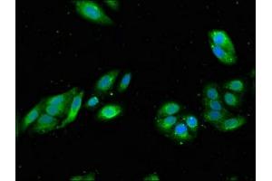 Immunofluorescent analysis of HepG2 cells using ABIN7167597 at dilution of 1:100 and Alexa Fluor 488-congugated AffiniPure Goat Anti-Rabbit IgG(H+L) (RGS19 antibody  (AA 1-87))