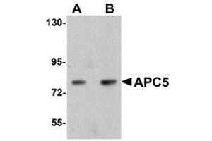 Western blot analysis of APC5 in human kidney tissue lysate with AP30061PU-N APC5 antibody at (A) 1 and (B) 2 μg/ml. (ANAPC5 antibody  (Center))