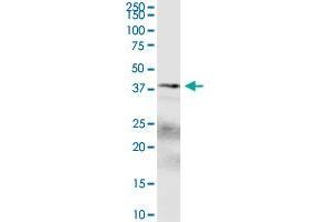SPDEF polyclonal antibody (A01). (SPDEF/PSE antibody  (AA 1-335))