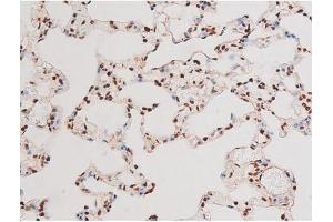 Immunohistochemistry (IHC) image for anti-Nuclear Factor-kB p65 (NFkBP65) (pThr435) antibody (ABIN6255688)